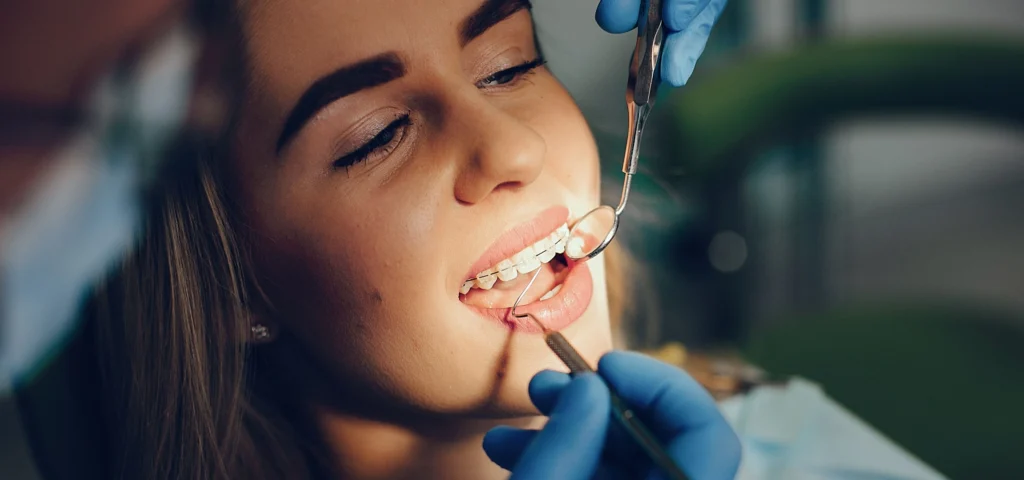 bagues dentaires classiques (2)