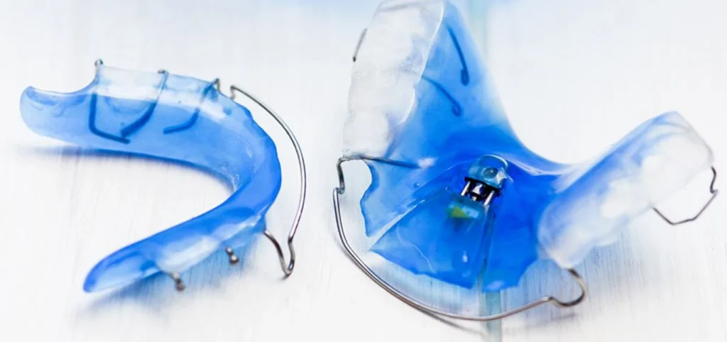 plaque palatine enfants plaque palatine orthodontie Orthodontiste enfant Troyes